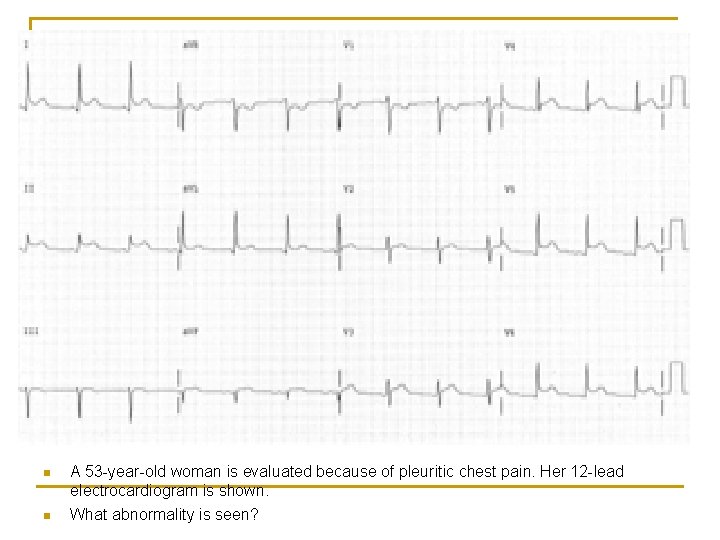n n A 53 -year-old woman is evaluated because of pleuritic chest pain. Her