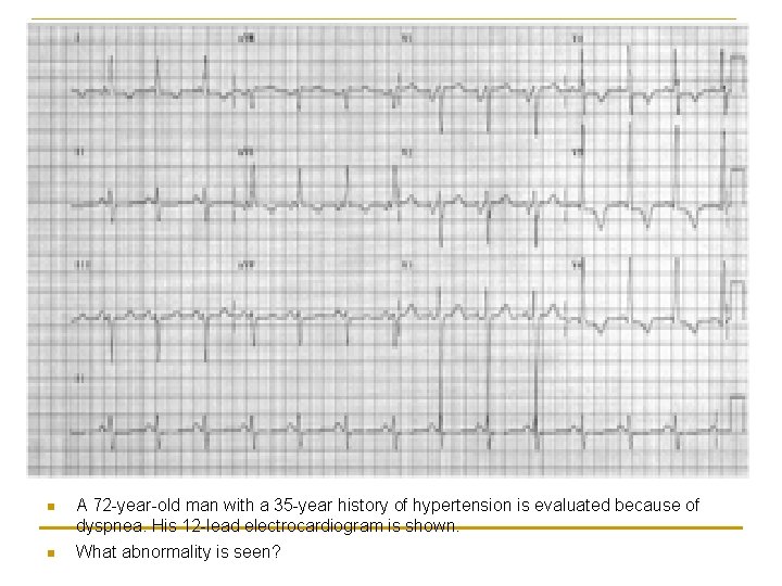 n n A 72 -year-old man with a 35 -year history of hypertension is