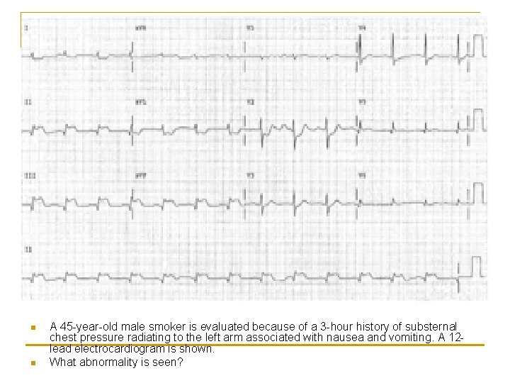 n n A 45 -year-old male smoker is evaluated because of a 3 -hour