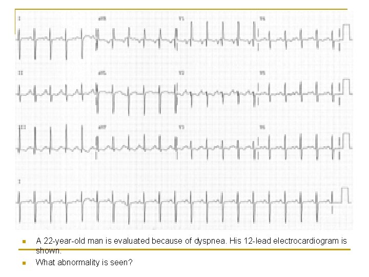 n n A 22 -year-old man is evaluated because of dyspnea. His 12 -lead