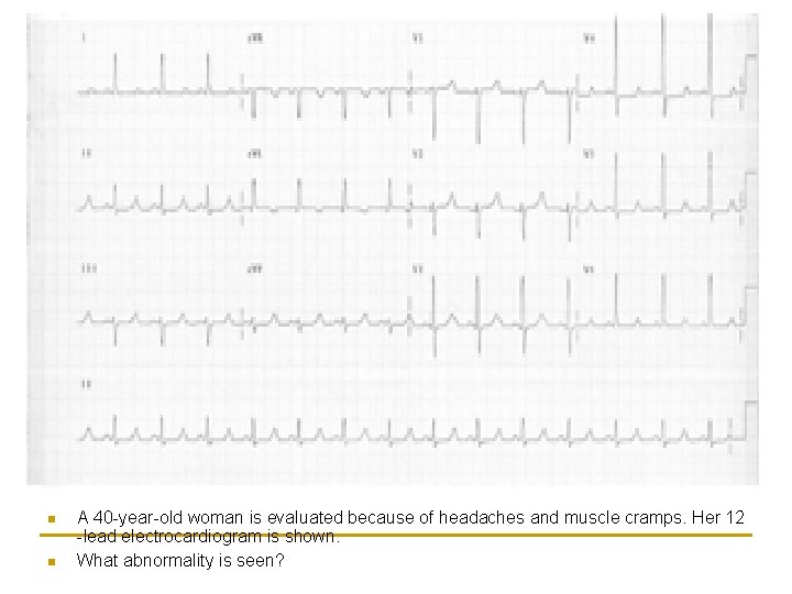 n n A 40 -year-old woman is evaluated because of headaches and muscle cramps.