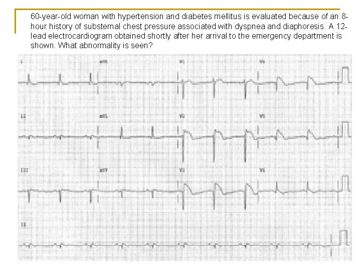 60 -year-old woman with hypertension and diabetes mellitus is evaluated because of an 8