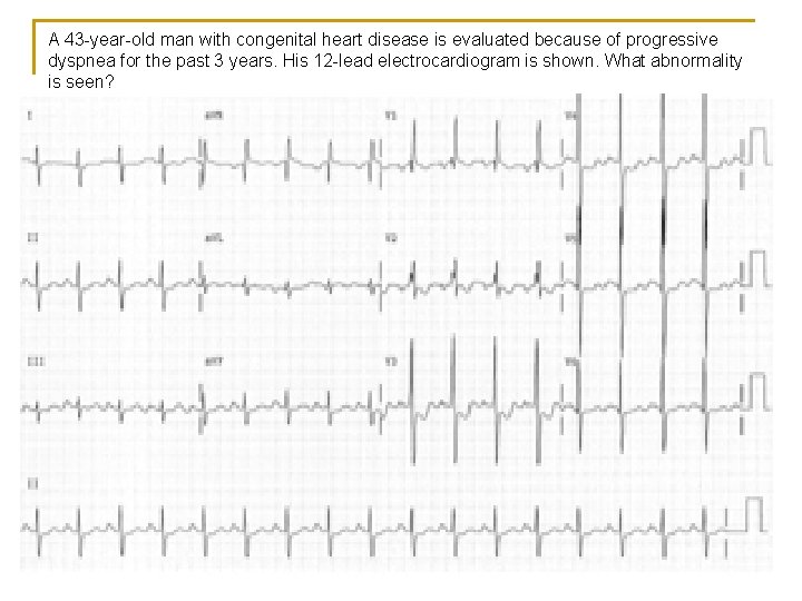 A 43 -year-old man with congenital heart disease is evaluated because of progressive dyspnea