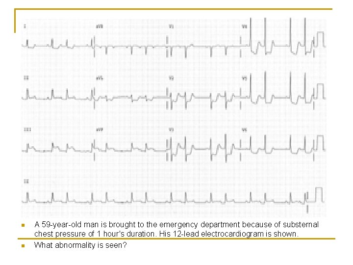 n n A 59 -year-old man is brought to the emergency department because of