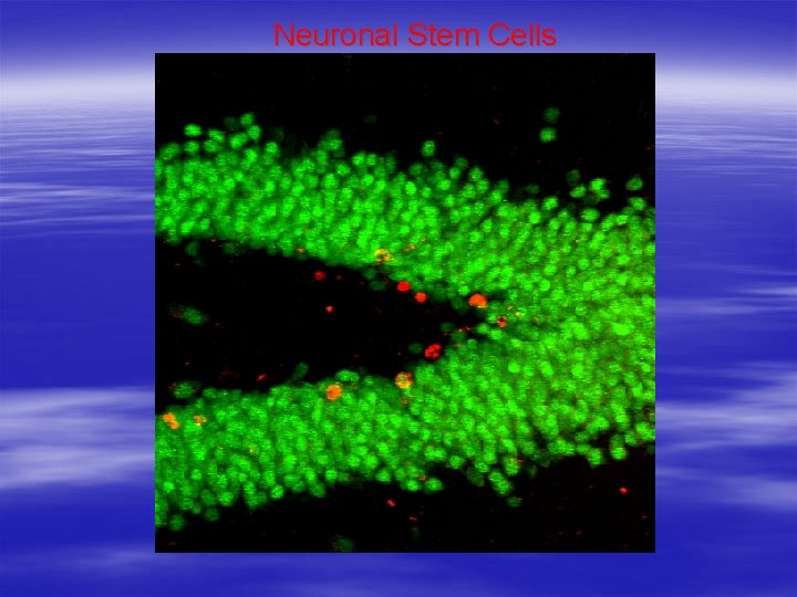 Neuronal Stem Cells 