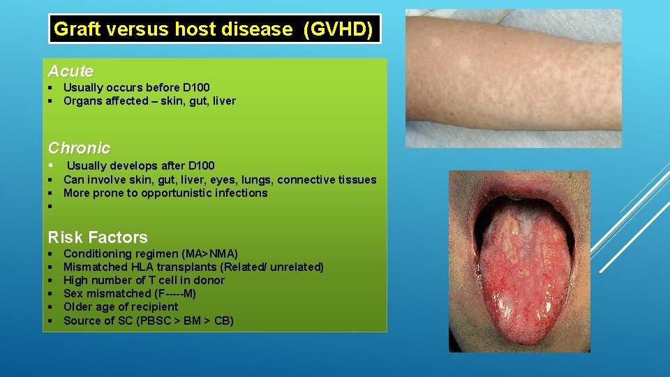 Graft versus host disease (GVHD) Acute § Usually occurs before D 100 § Organs