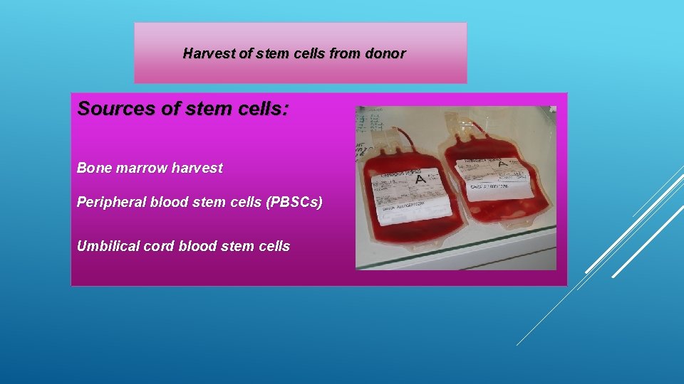 Harvest of stem cells from donor Sources of stem cells: Bone marrow harvest Peripheral