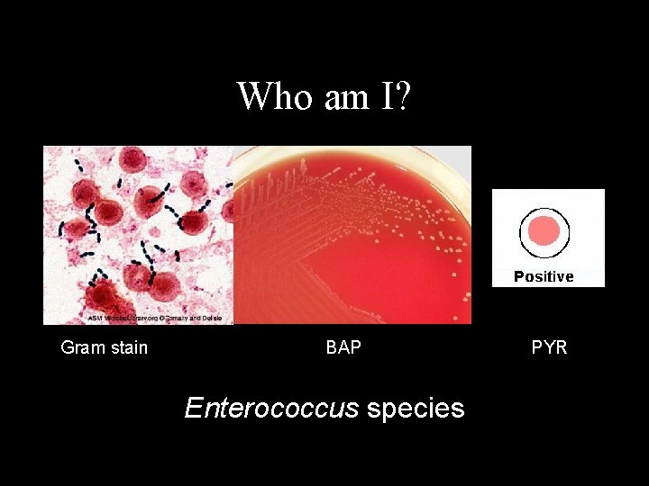 Who am I? Gram stain BAP Enterococcus species PYR 