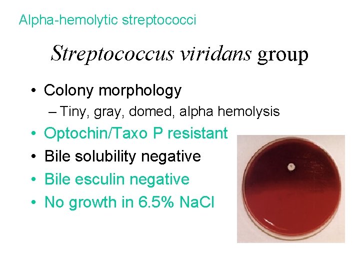 Alpha-hemolytic streptococci Streptococcus viridans group • Colony morphology – Tiny, gray, domed, alpha hemolysis