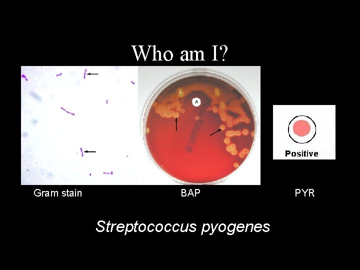 Who am I? Gram stain BAP Streptococcus pyogenes PYR 