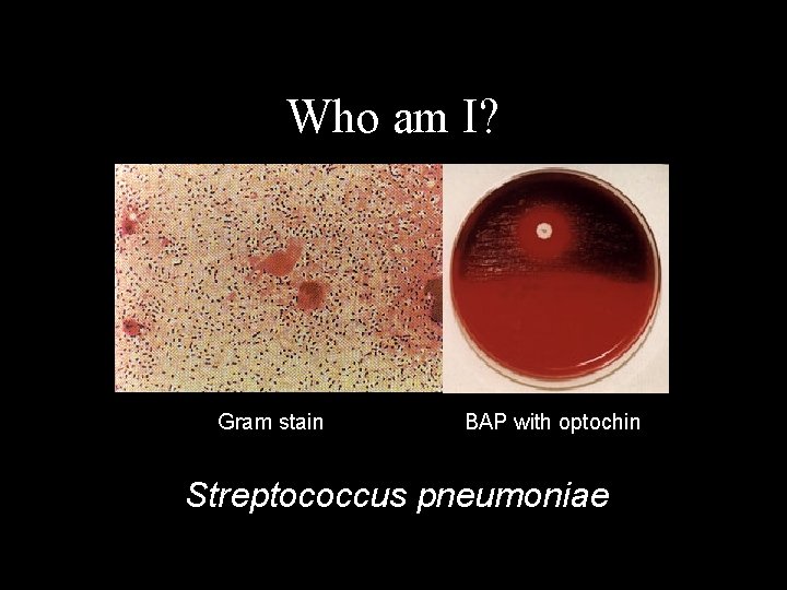 Who am I? Gram stain BAP with optochin Streptococcus pneumoniae 