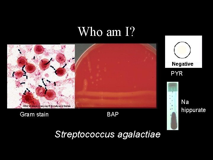 Who am I? PYR Gram stain BAP Streptococcus agalactiae Na hippurate 