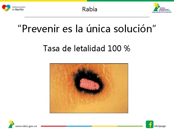 Rabia “Prevenir es la única solución” Tasa de letalidad 100 % 