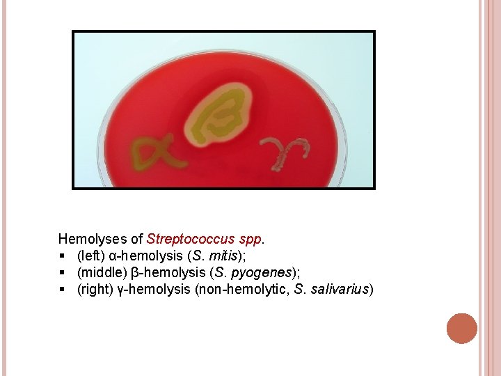 Hemolyses of Streptococcus spp. § (left) α-hemolysis (S. mitis); § (middle) β-hemolysis (S. pyogenes);