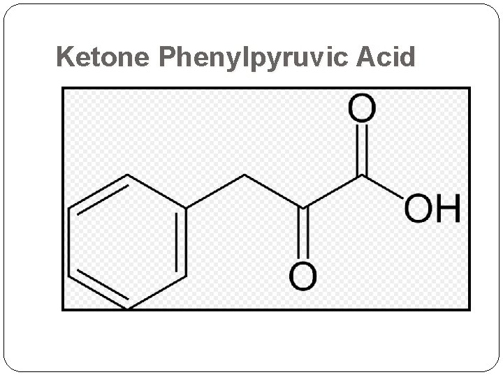 Ketone Phenylpyruvic Acid  Ketone Phenylpyruvic Acid