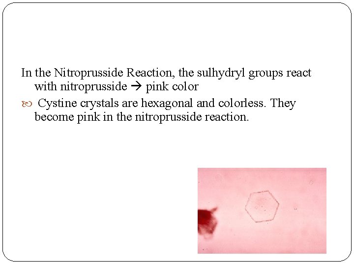 In the Nitroprusside Reaction, the sulhydryl groups react with nitroprusside pink color Cystine crystals In the Nitroprusside Reaction, the sulhydryl groups react with nitroprusside pink color Cystine crystals