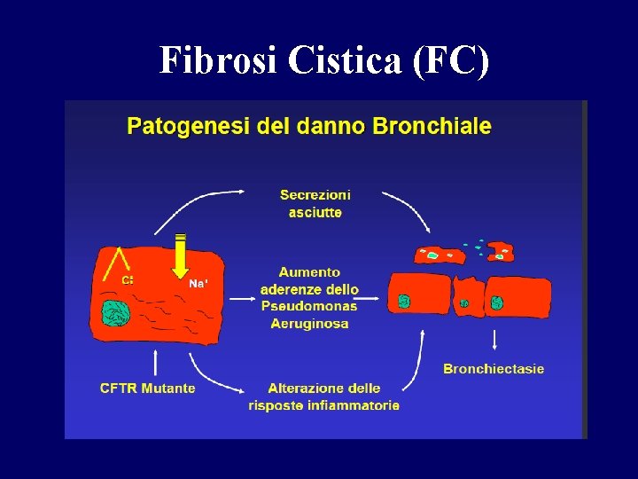 Fibrosi Cistica (FC) 