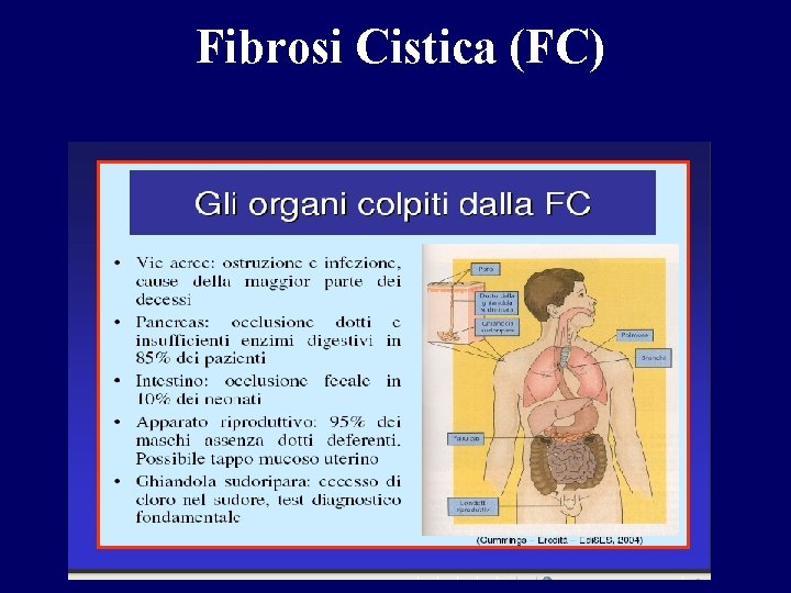 Fibrosi Cistica (FC) 