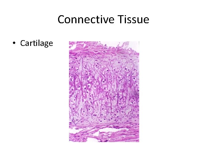 Connective Tissue • Cartilage 