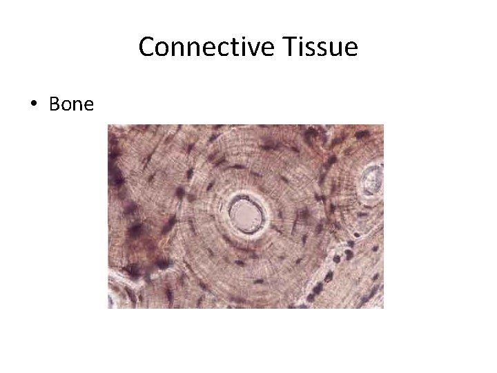 Connective Tissue • Bone 