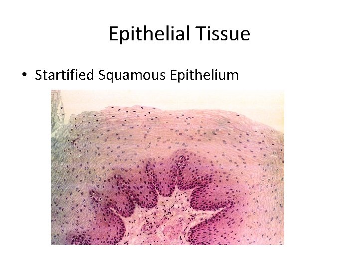 Epithelial Tissue • Startified Squamous Epithelium 