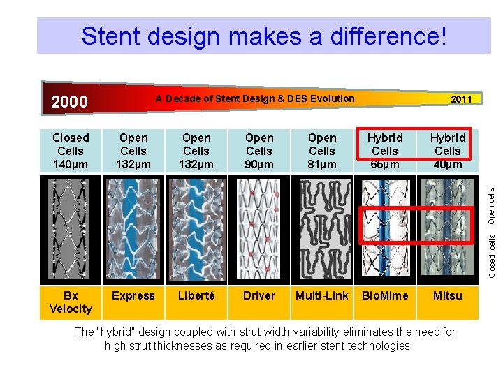 Stent design makes a difference! 2000 A Decade of Stent Design & DES Evolution