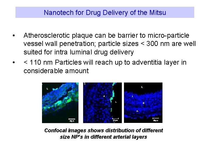 Nanotech for Drug Delivery of the Mitsu • • Atherosclerotic plaque can be barrier