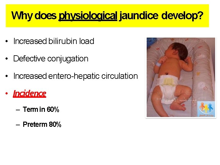 Why does physiological jaundice develop? • Increased bilirubin load • Defective conjugation • Increased