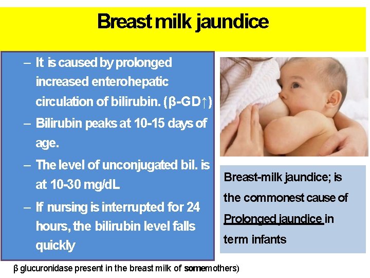 Breast milk jaundice – It is caused by prolonged increased enterohepatic circulation of bilirubin. Breast milk jaundice – It is caused by prolonged increased enterohepatic circulation of bilirubin.