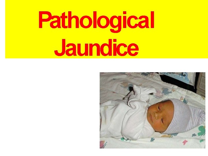 Pathological Jaundice Pathological Jaundice