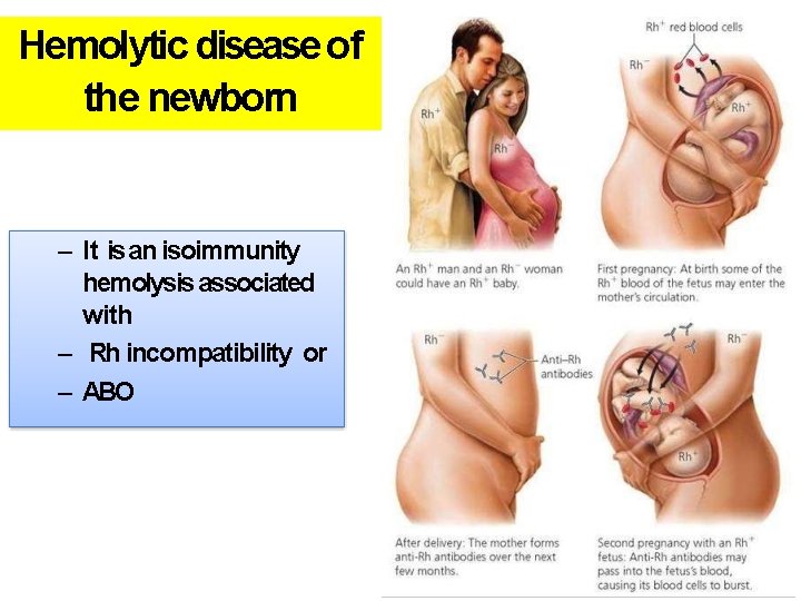 Hemolytic disease of the newborn – It is an isoimmunity hemolysis associated with –