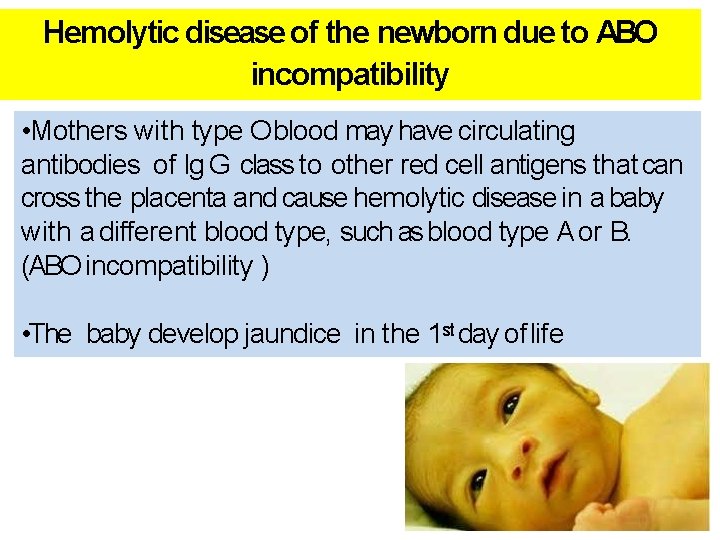 Hemolytic disease of the newborn due to ABO incompatibility • Mothers with type O Hemolytic disease of the newborn due to ABO incompatibility • Mothers with type O