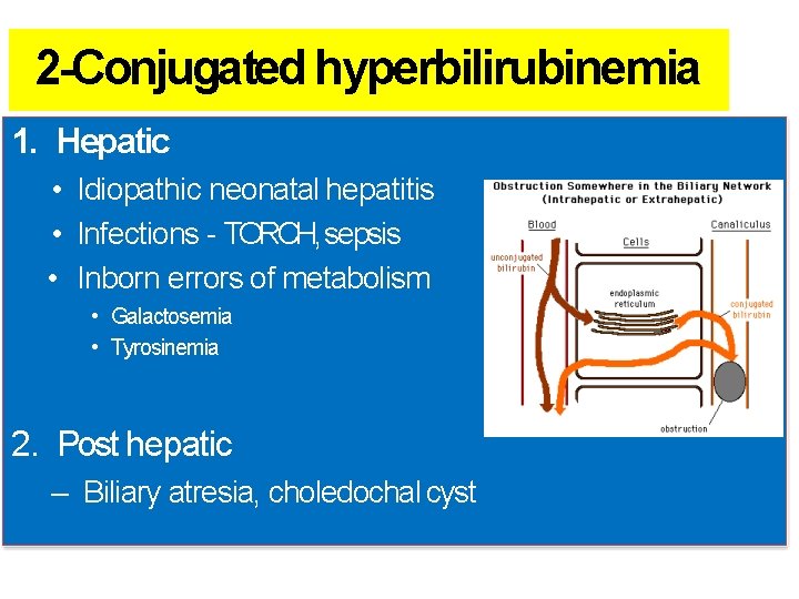 2 -Conjugated hyperbilirubinemia 1. Hepatic • Idiopathic neonatal hepatitis • Infections - TORCH, sepsis