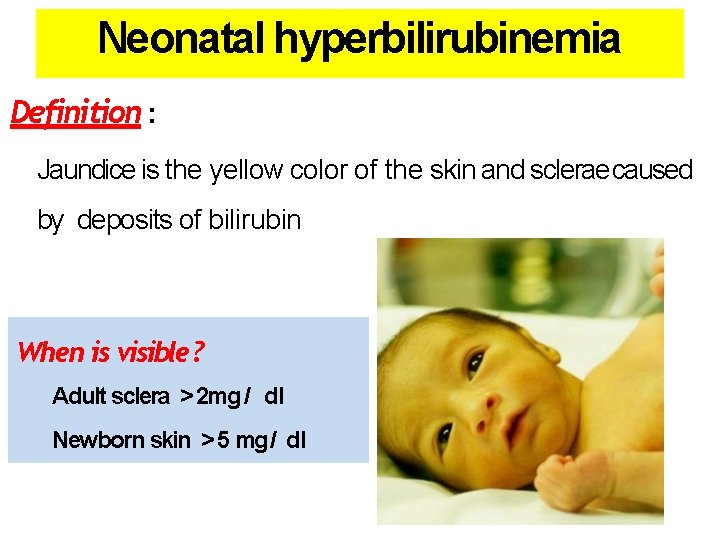 Neonatal hyperbilirubinemia Definition : Jaundice is the yellow color of the skin and sclerae