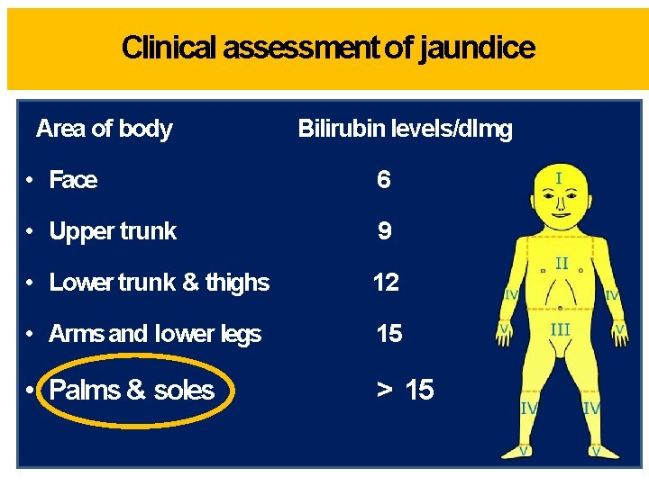 Clinical assessment of jaundice Area of body Bilirubin levels/dlmg • Face 6 • Upper