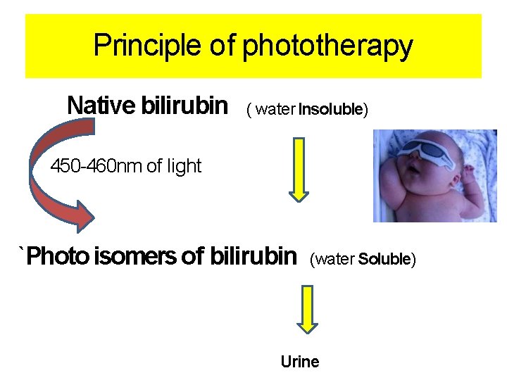 Principle of phototherapy Native bilirubin ( water Insoluble) 450 -460 nm of light `Photo