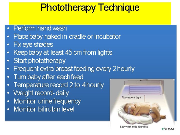 Phototherapy Technique • • • Perform hand wash Place baby naked in cradle or