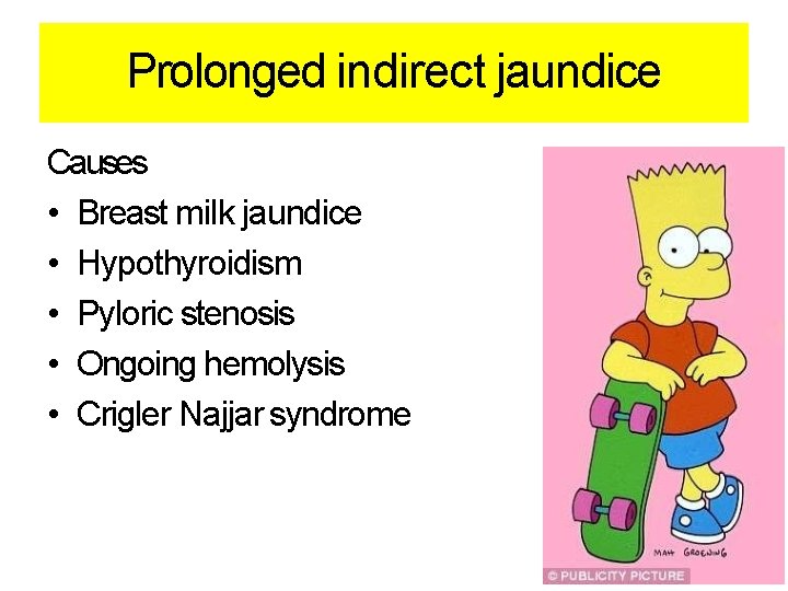 Prolonged indirect jaundice Causes • Breast milk jaundice • Hypothyroidism • Pyloric stenosis •
