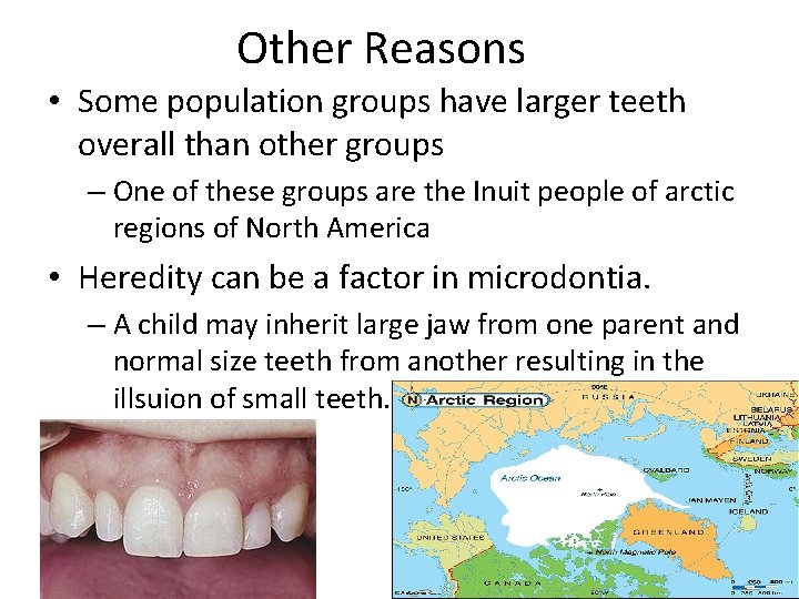 Other Reasons • Some population groups have larger teeth overall than other groups –