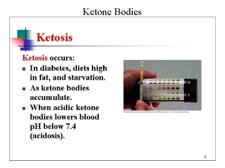 Ketone Bodies 