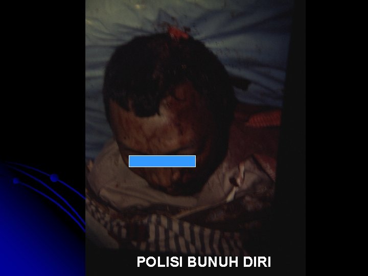 POLISI BUNUH DIRI 