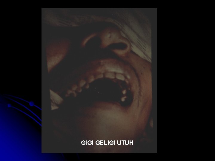 GIGI GELIGI UTUH 