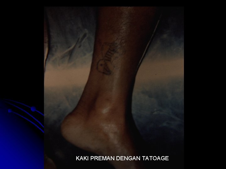 KAKI PREMAN DENGAN TATOAGE 