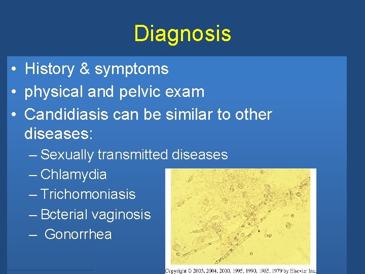 Diagnosis • History & symptoms • physical and pelvic exam • Candidiasis can be