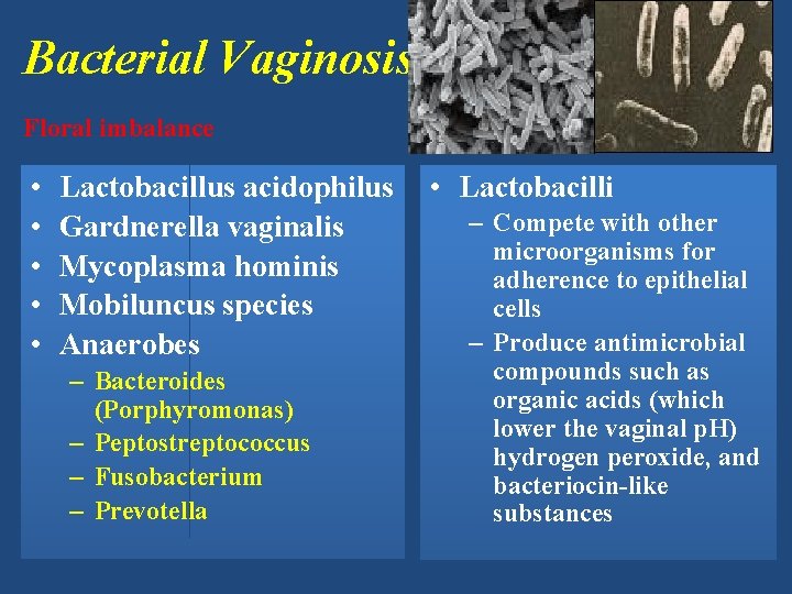 Bacterial Vaginosis Floral imbalance • • • Lactobacillus acidophilus Gardnerella vaginalis Mycoplasma hominis Mobiluncus