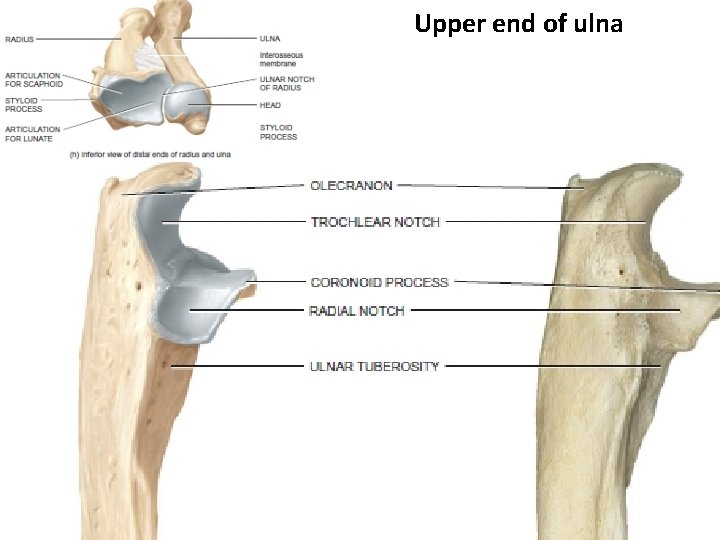 Upper end of ulna 