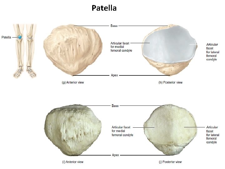 Patella 