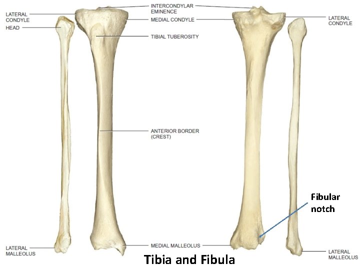 Fibular notch Tibia and Fibula 