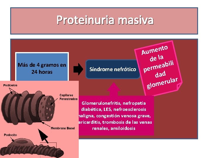 Proteinuria masiva Más de 4 gramos en 24 horas to n e m Au