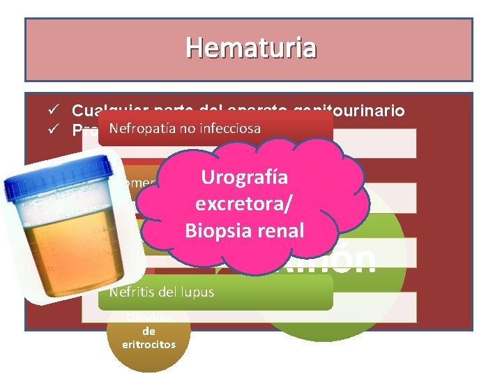 Hematuria ü Cualquier parte del aparato genitourinario Nefropatía no infecciosa ü Procesos inflamatorios Urografía